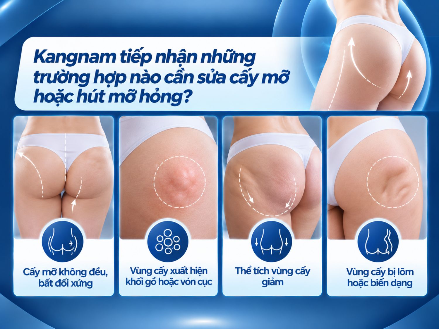 Sau cấy mỡ hoặc hút mỡ, một số khách hàng có thể gặp tình trạng vùng điều trị không cân đối, xuất hiện khối gồ, vón cục, lõm hoặc biến dạng. Tại Bệnh viện Thẩm mỹ Kangnam, bác sĩ sẽ thăm khám, đánh giá mức độ tổn thương và xác định nguyên nhân để tư vấn phương án khắc phục phù hợp với từng trường hợp.