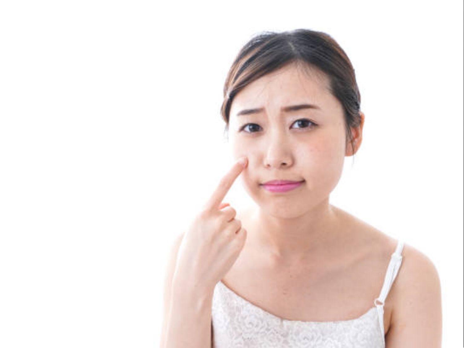 Da khổ và xỉn màu khiến người gặp phải thấy khó chịu