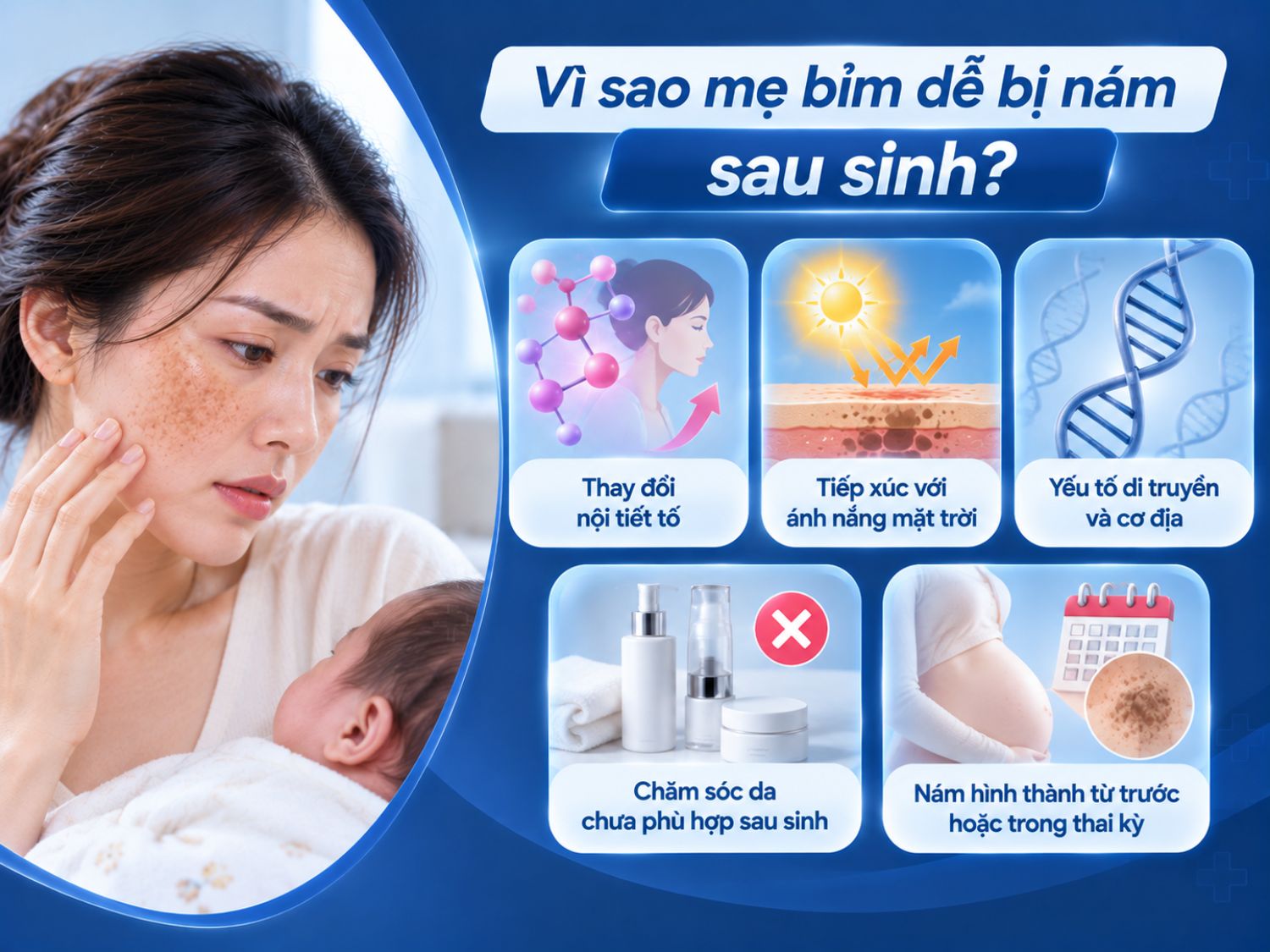 Thay đổi nội tiết tố, tiếp xúc với ánh nắng và yếu tố cơ địa có thể khiến nám xuất hiện hoặc trở nên rõ hơn sau sinh.