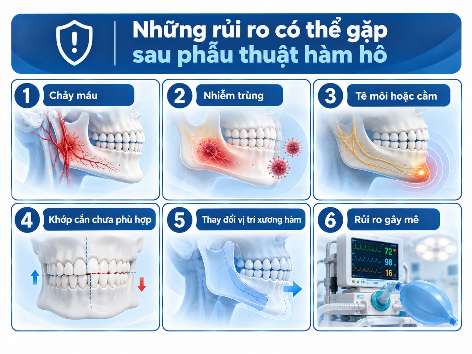 ảnh mô tả Phẫu thuật hàm hô có thể gặp các rủi ro như chảy máu, nhiễm trùng, tê môi hoặc cằm, sai lệch khớp cắn, thay đổi vị trí xương hàm sau phẫu thuật và biến chứng liên quan đến gây mê
