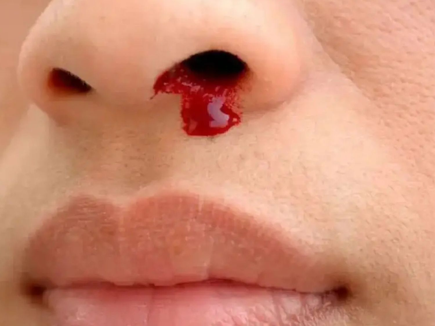 Chảy máu cần theo dõi nếu có những biểu hiện bất thường