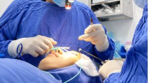 Nâng mũi có đau không, đau mức độ nào so với nhổ răng khôn?