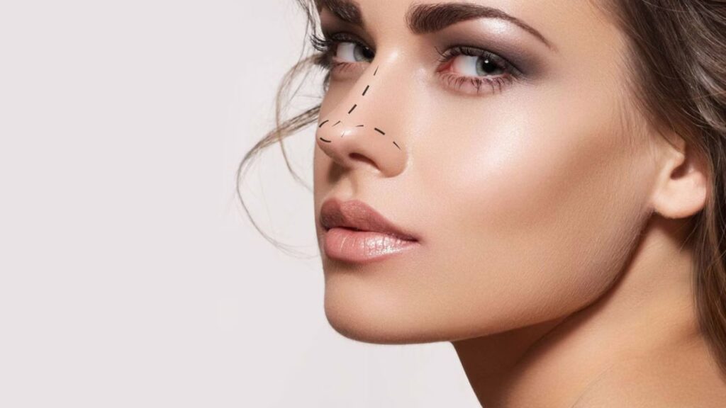 Nếu nâng mũi hỏng thì có thể trở về mũi ban đầu được không?