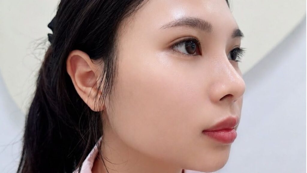 Nâng mũi sụn sườn hết bao nhiêu tiền?