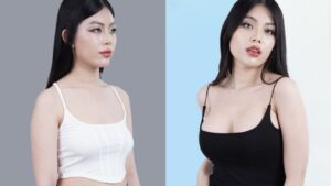Nâng ngực ở đâu uy tín TP.HCM? Khám phá địa chỉ nâng ngực an toàn tại Sài Gòn