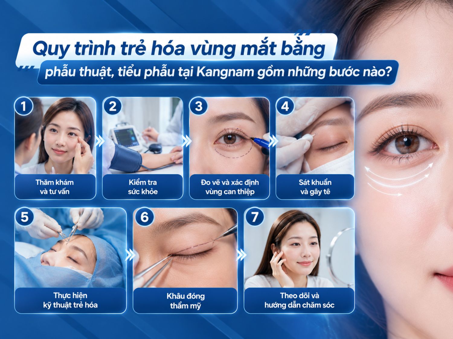 Quy trình trẻ hóa vùng mắt tại Kangnam gồm thăm khám, kiểm tra sức khỏe, đo vẽ vùng can thiệp, sát khuẩn và gây tê, thực hiện kỹ thuật, khâu đóng thẩm mỹ và hướng dẫn chăm sóc sau thủ thuật.