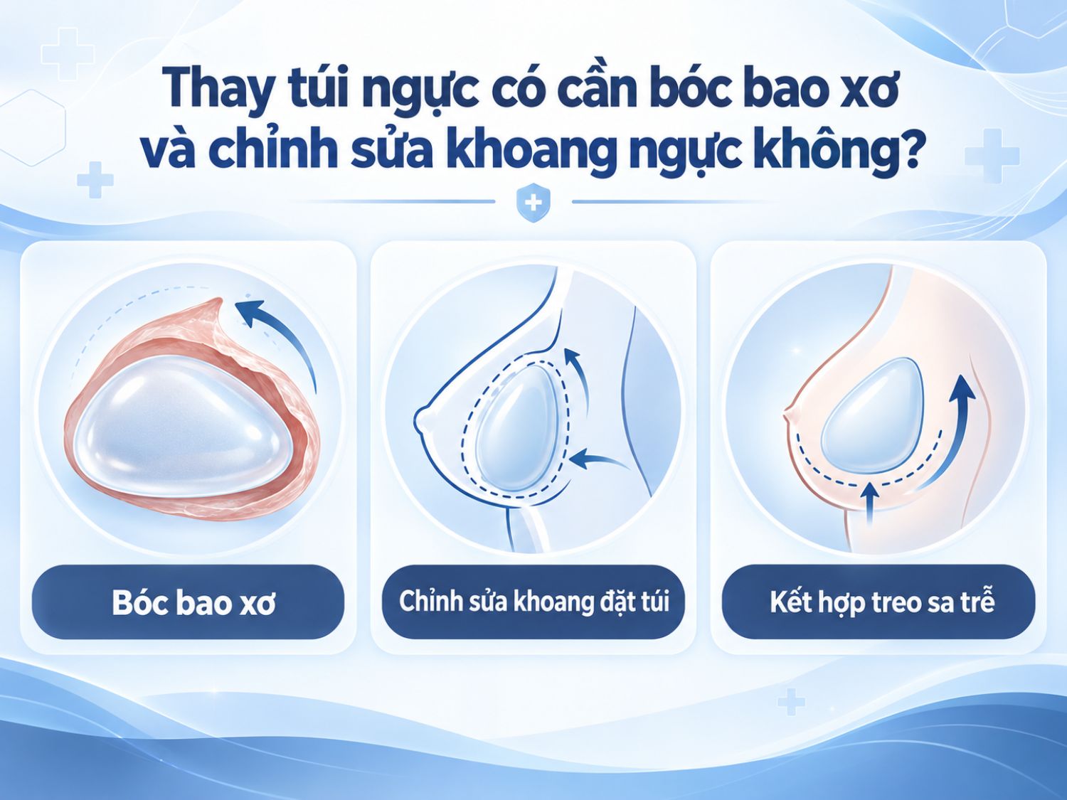 Khi thay túi ngực, bác sĩ có thể chỉ định bóc bao xơ, chỉnh sửa khoang đặt túi hoặc kết hợp treo sa trễ tùy theo tình trạng bao xơ, vị trí túi ngực và mức độ chảy xệ. Không phải trường hợp nào cũng cần thực hiện cả ba kỹ thuật.
