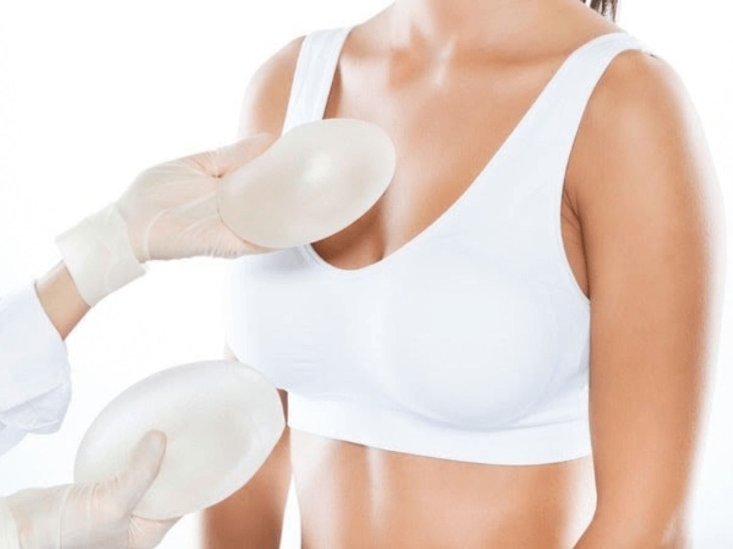 Khi thay túi ngực, bác sĩ cần đánh giá tình trạng túi cũ, bao xơ và khoang đặt túi để lựa chọn loại túi mới cùng phương án phẫu thuật phù hợp.