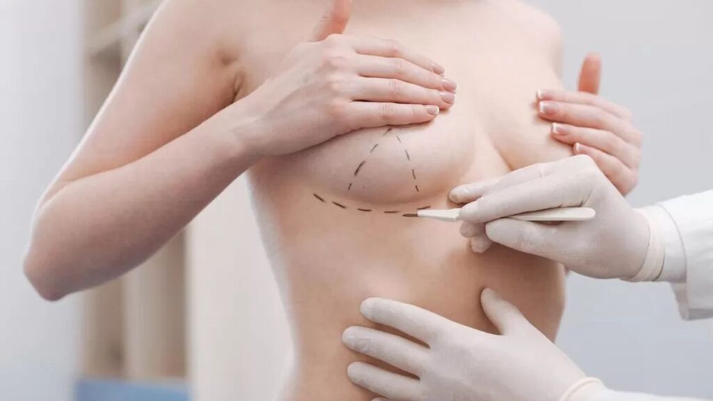 Thu nhỏ ngực giá bao nhiêu? Bảng giá phẫu thuật thu gọn vú mới nhất