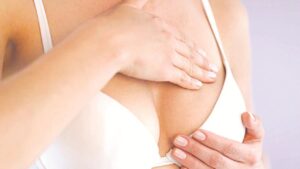 Thu nhỏ ngực ở đâu an toàn? Nên khám bác sĩ chuyên khoa gì?
