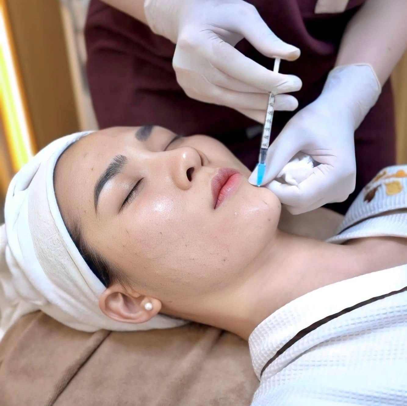Tiêm Mesotherapy giúp da ngậm nước nhanh chóng