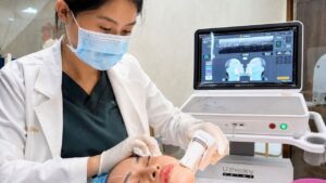 Trẻ hoá máy hay căng da: 52 tuổi da má chùng nên chọn phương pháp nào?