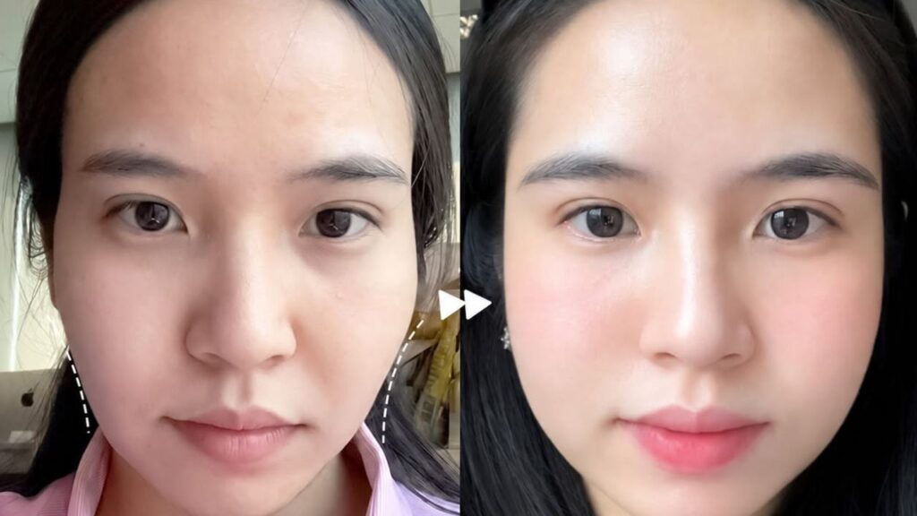 Trẻ hoá cho người 30 tuổi: Có vết chân chim nên làm gì?