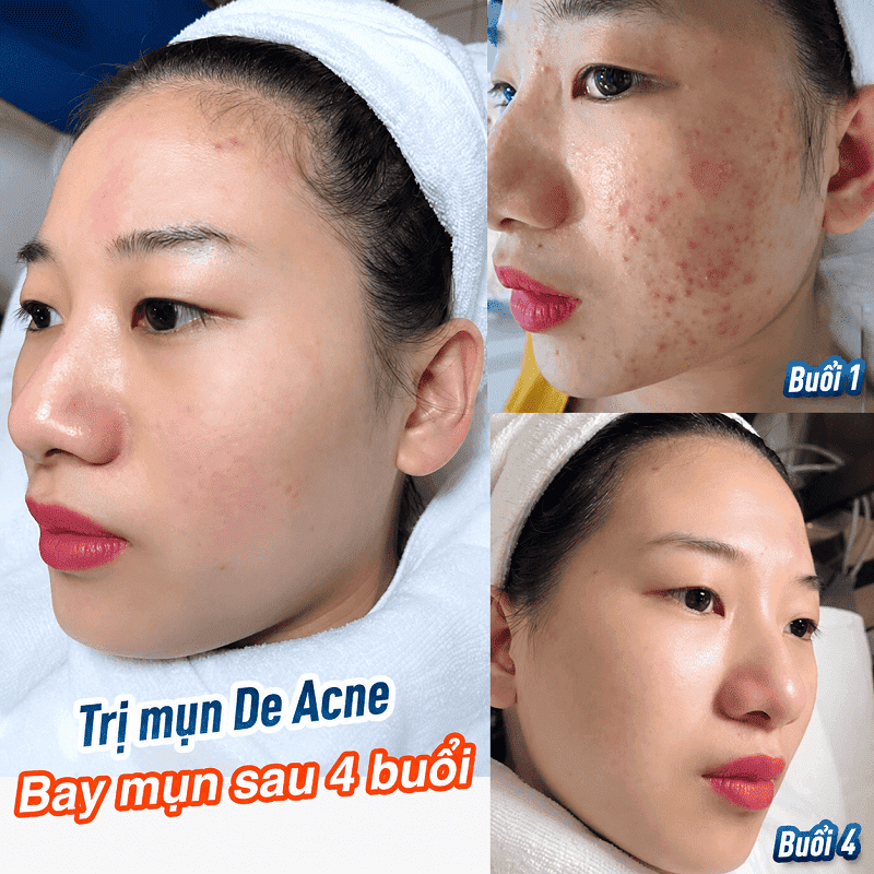 Kangnam trị mụn có bác sĩ khám không? Đội ngũ bác sĩ da liễu trực tiếp thăm khám