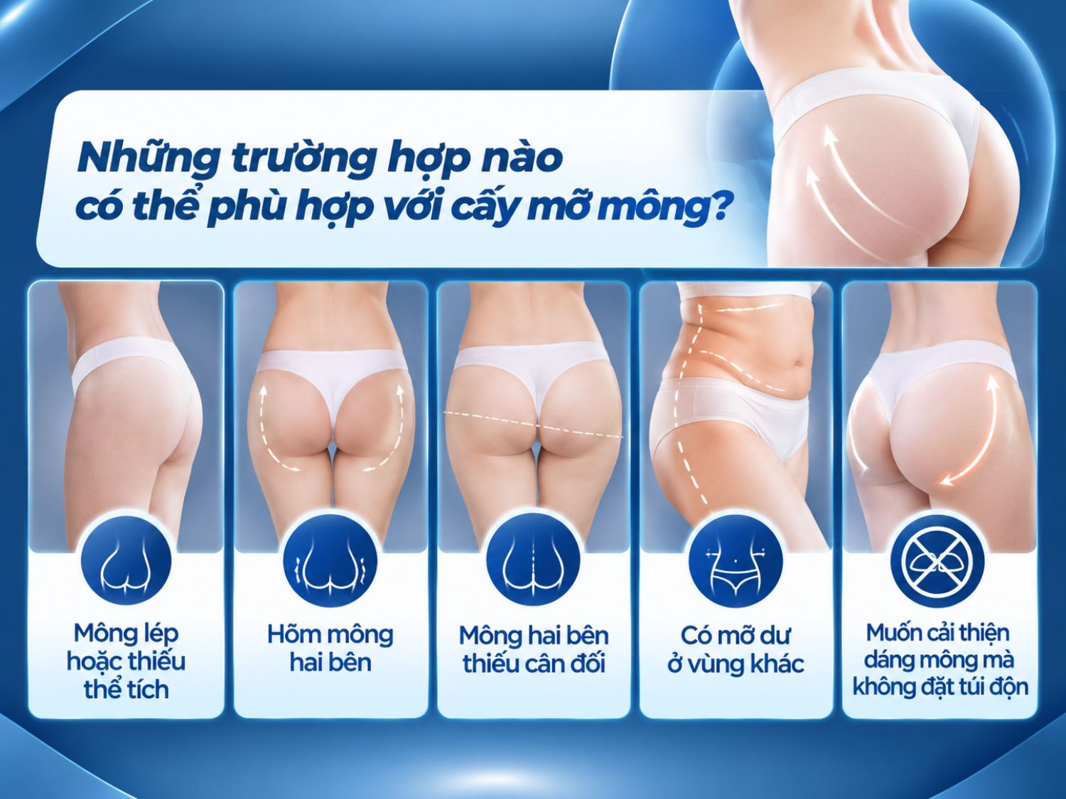 Cấy mỡ mông tự thân có thể được cân nhắc cho người có vòng mông nhỏ, thiếu độ đầy đặn, hõm mông hoặc hai bên chưa cân đối. Phương pháp sử dụng mỡ lấy từ chính cơ thể để bổ sung thể tích vùng mông. Tuy nhiên, khách hàng cần được bác sĩ đánh giá lượng mỡ dự trữ, tình trạng sức khỏe và các nguy cơ phẫu thuật trước khi thực hiện.