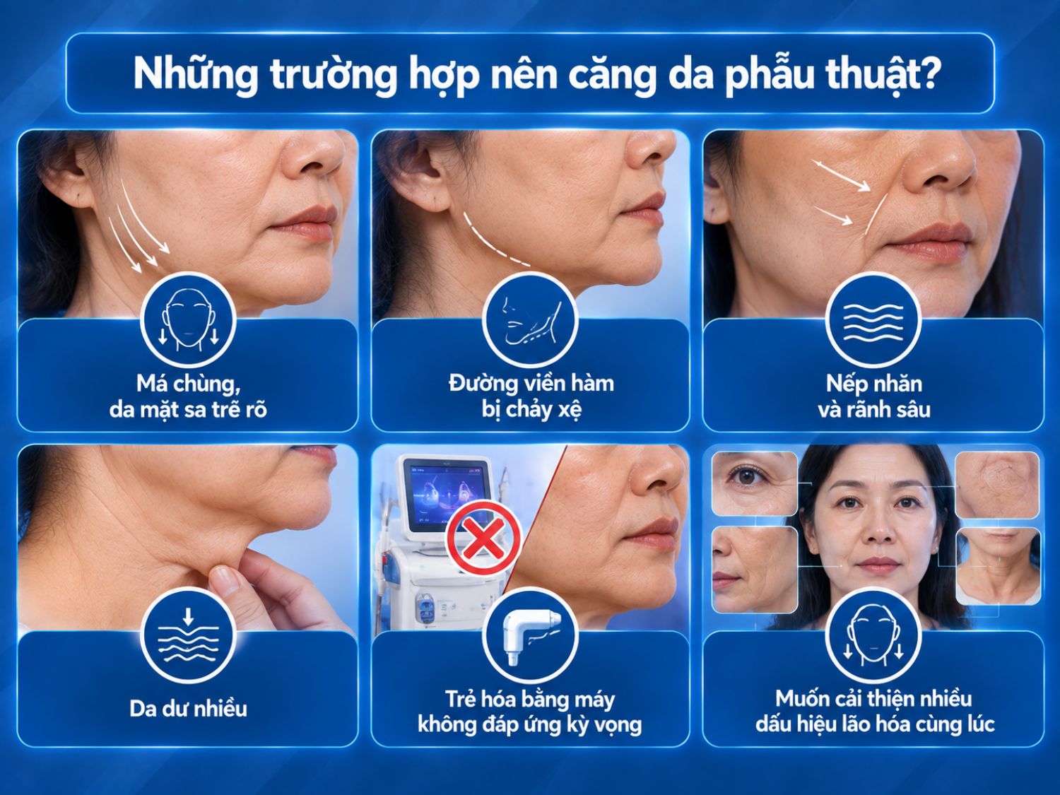 Phẫu thuật căng da mặt có thể được cân nhắc khi má và đường viền hàm sa trễ rõ, có nhiều da dư, nếp nhăn hoặc rãnh sâu và các phương pháp trẻ hóa bằng máy chưa đáp ứng kỳ vọng.