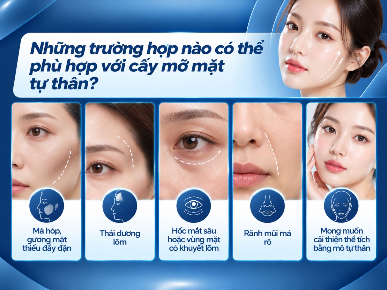 Cấy mỡ mặt tự thân có thể được cân nhắc cho người có má hóp, thái dương lõm, hốc mắt sâu, rãnh mũi má rõ hoặc các vùng mặt thiếu thể tích. Bác sĩ sẽ thăm khám, đánh giá cấu trúc khuôn mặt, lượng mỡ dự trữ và tình trạng sức khỏe để xác định phương pháp phù hợp.