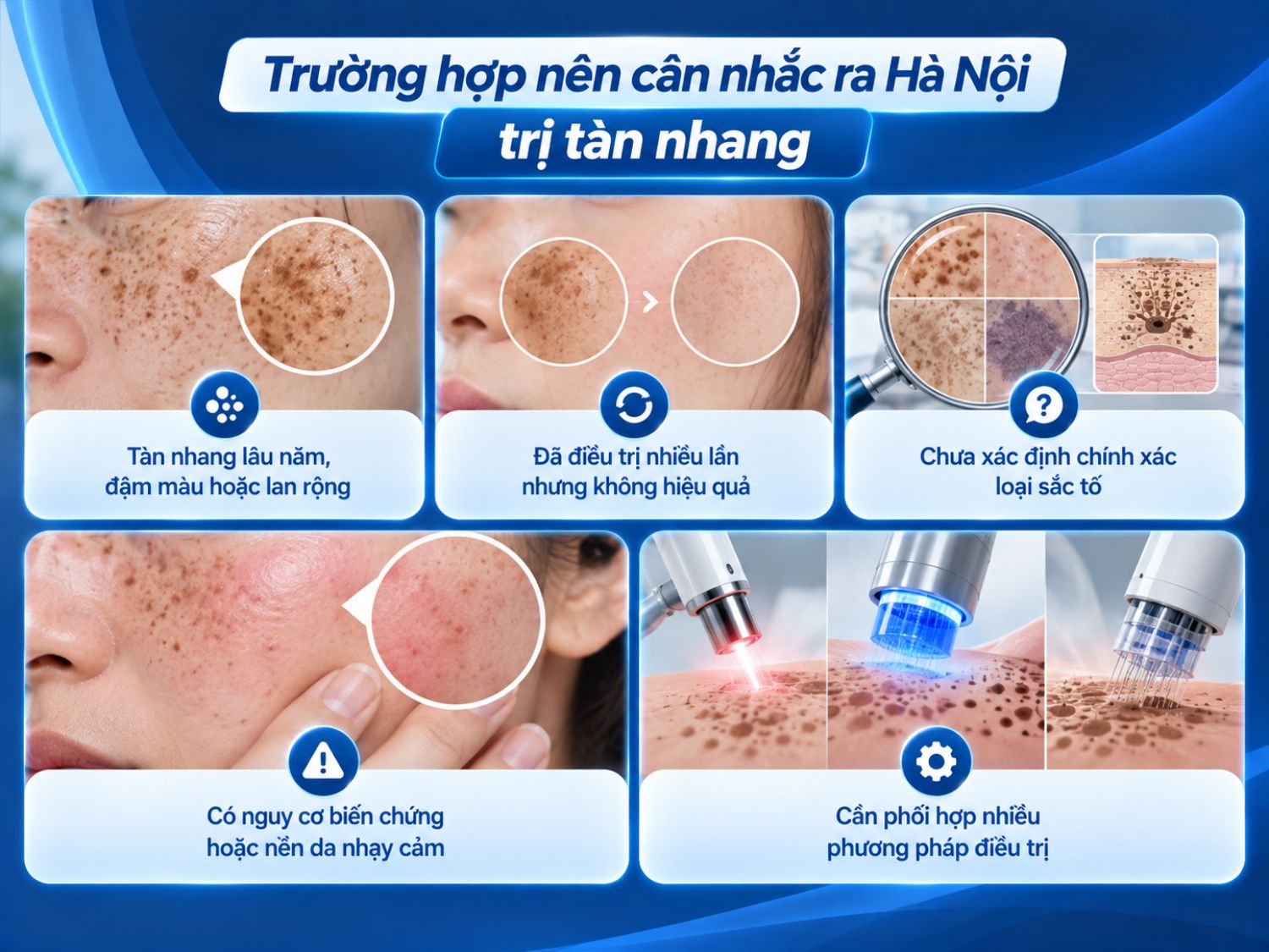 Người có tàn nhang đậm màu, tái phát sau nhiều lần điều trị hoặc tình trạng sắc tố phức tạp có thể cân nhắc đến cơ sở chuyên khoa tại Hà Nội để được đánh giá và lựa chọn phương pháp phù hợp.
