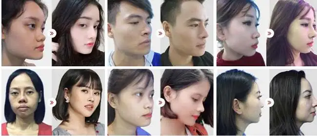 khách hàng bvtm kangnam