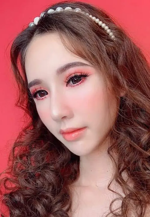 hình ảnh phan thị may sau thẩm mỹ