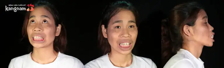 Cao Thị Lan Hành trình lột xác 2018 - 3