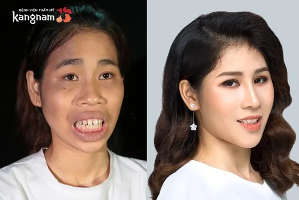 cao thị lan hành trình lột xác 2018