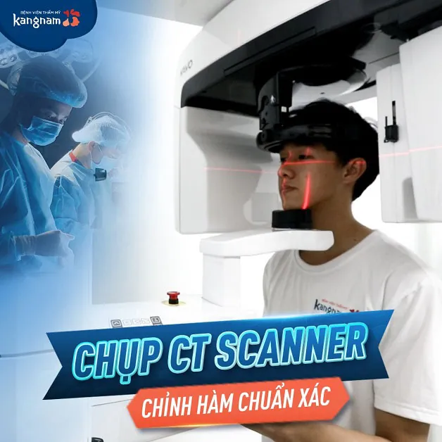 Chụp CT Scanner trước khi chỉnh hàm mặt