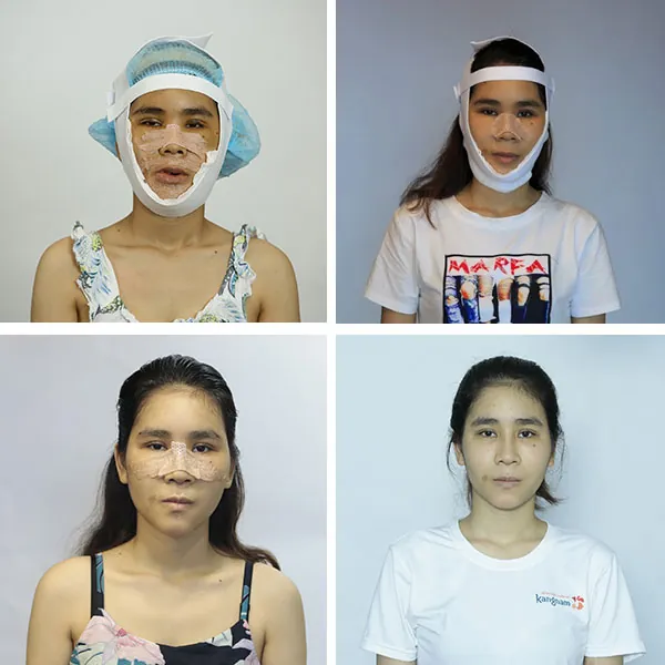 hồi phục cao thị lan