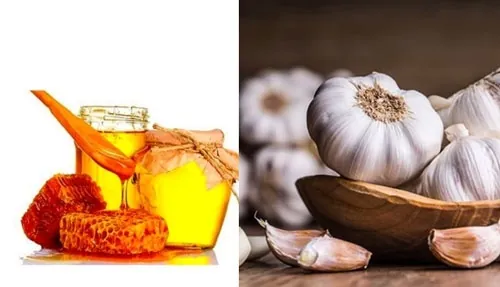 Phá nốt ruồi bằng tỏi và mật ong