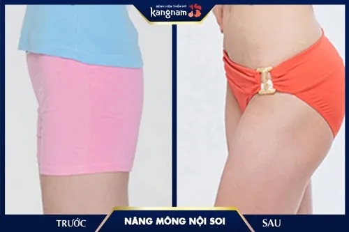 làm thế nào để mông to hơn