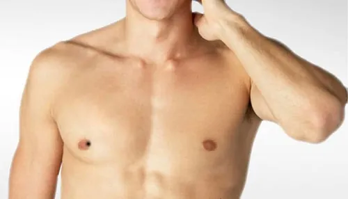 nốt ruồi ở nhũ hoa đàn ông