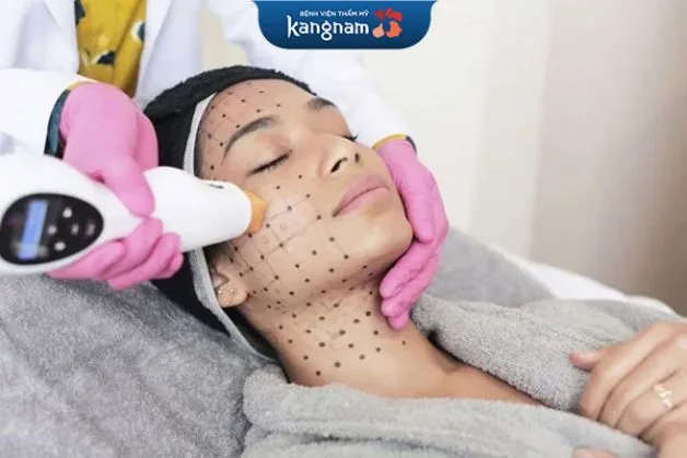 Cơ chế hoạt động Thermage FLX