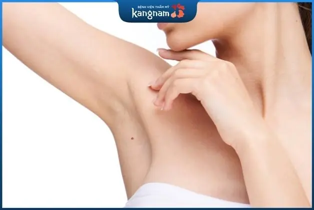 Nốt ruồi ở nách là một dấu hiệu điềm lành