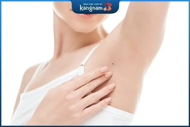 Nốt ruồi trên nách trái nữ