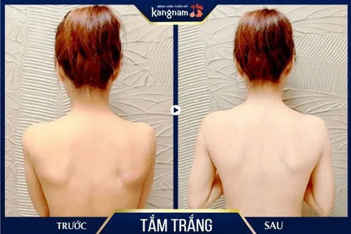 tắm trắng có hại da không