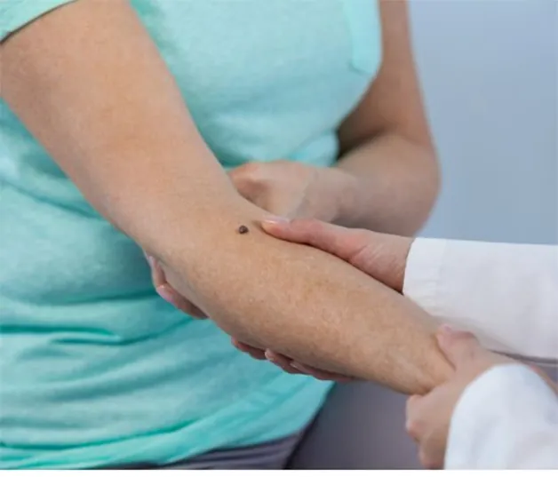 Ý nghĩa nốt ruồi mọc trên cánh tay phải đàn ông