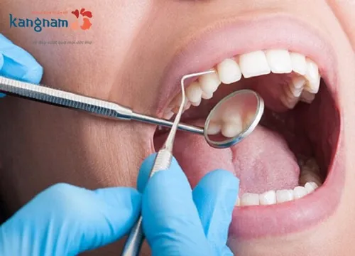 lấy cao răng xong bị ê răng