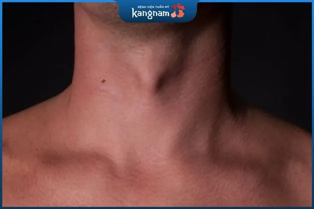 Người có nốt ruồi bên phải dù là cả nam hay nữ đều là những người có tính cách phóng khoáng