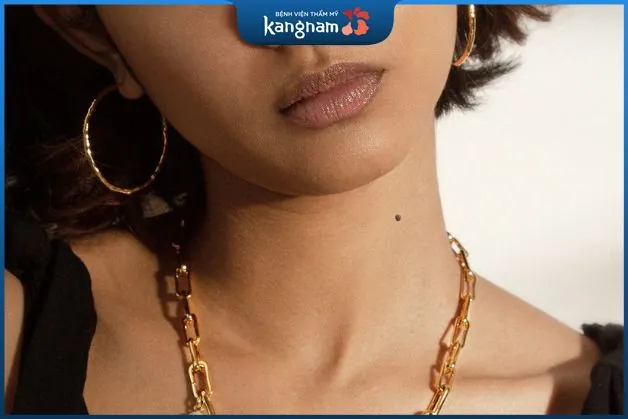 Phụ nữ có tướng nốt ruồi trên cổ thường có được sự nghiệp như ý