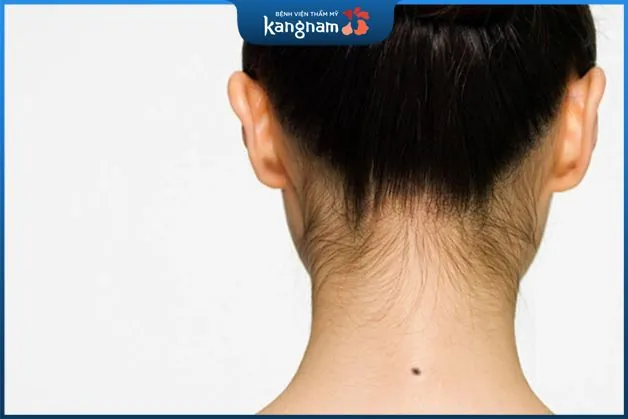 Người có nốt ruồi sau cổ thường là người khiêm tốn