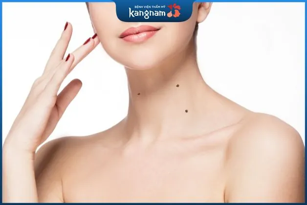 Mụn ruồi quanh cổ thường là người chung thủy