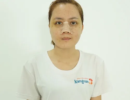 phùng thị mỹ duyên hồi phục sau 30 ngày