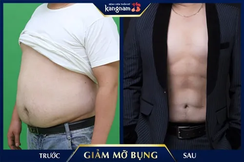 cách làm giảm mỡ bụng cho dân văn phòng