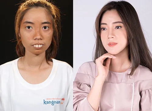 nguyễn thị huê hành trình lột xác tại kangnam