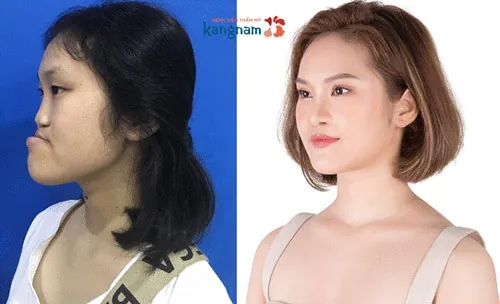 chương trình thay đổi cuộc sống phạm thị duyên 