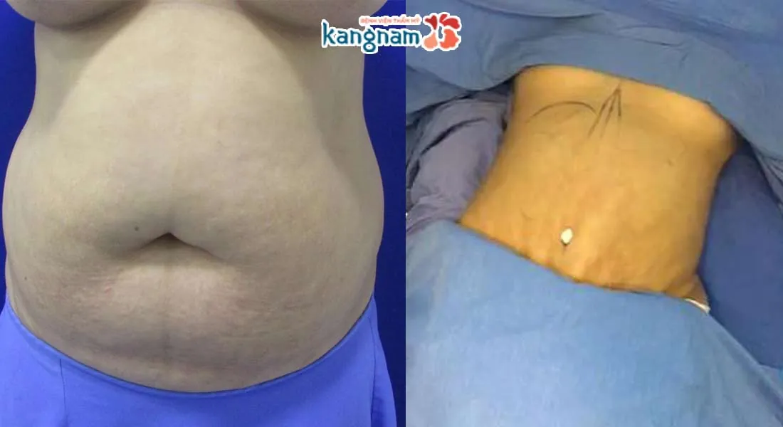 cách giảm cân vào mùa đông