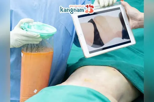 giảm cân vào mùa đông