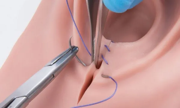 thời điểm khâu tầng sinh môn