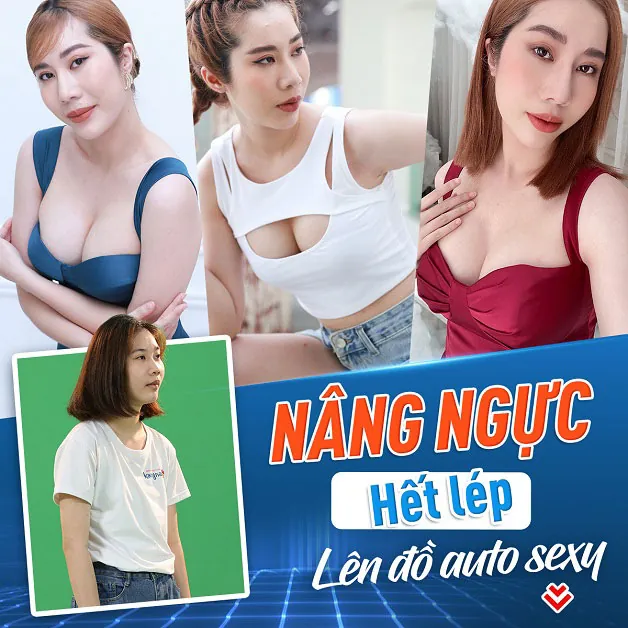 Nâng ngực phong thuỷ