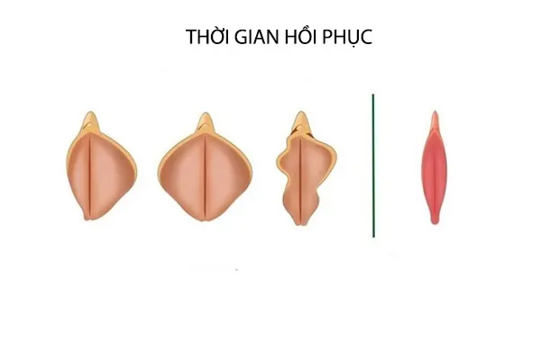 thời gian hồi phục